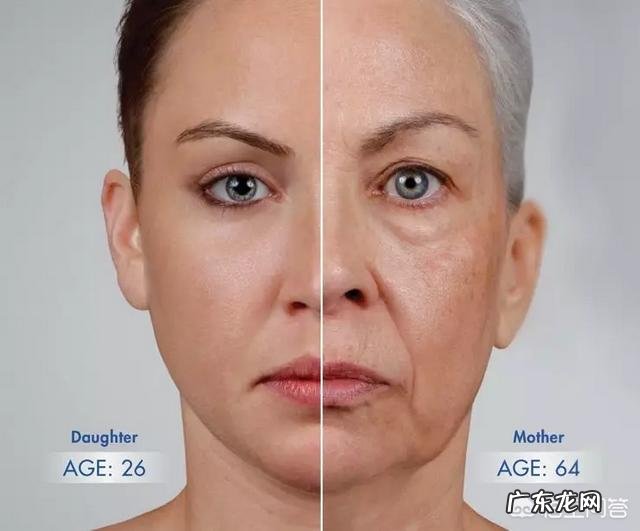 填充泪沟要注意什么,有哪些好的建议?