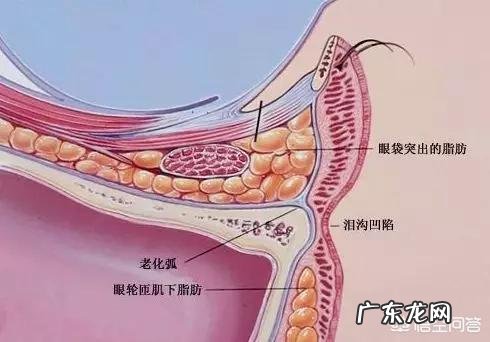 填充泪沟要注意什么,有哪些好的建议?