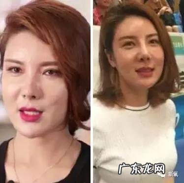 整容失败修复成功案例 你们有没有见过或者听说过一些整容失败的案例?