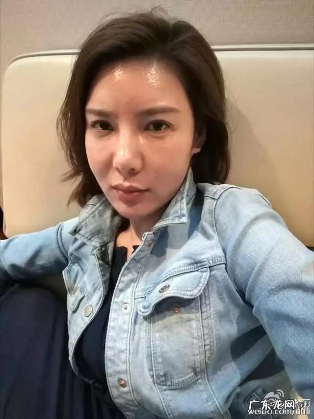 整容失败修复成功案例 你们有没有见过或者听说过一些整容失败的案例?