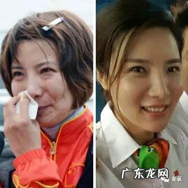 整容失败修复成功案例 你们有没有见过或者听说过一些整容失败的案例?