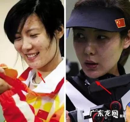 整容失败修复成功案例 你们有没有见过或者听说过一些整容失败的案例?