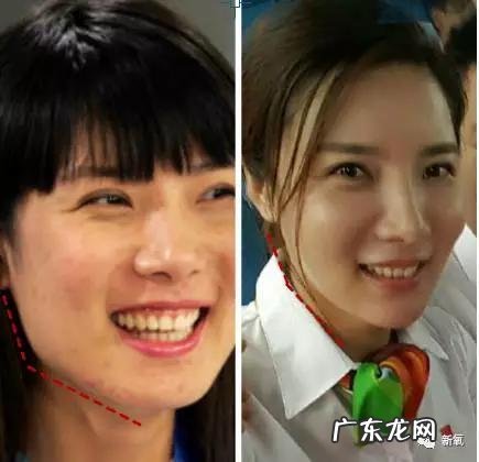 整容失败修复成功案例 你们有没有见过或者听说过一些整容失败的案例?