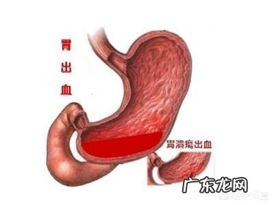 喝酒后服用阿司匹林肠溶片对身体有什么危害？