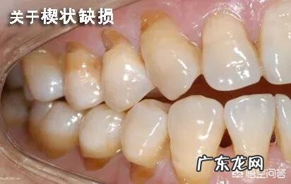 你平时有哪些保养牙齿的好习惯