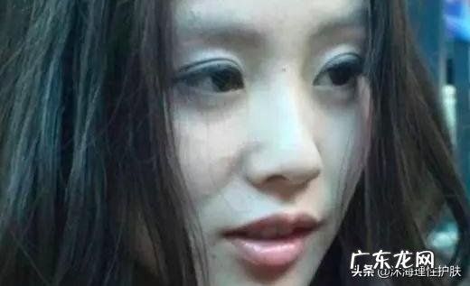 如何祛除法令纹和抬头纹？