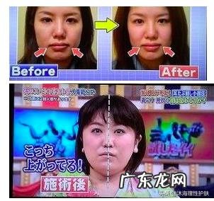 如何祛除法令纹和抬头纹？