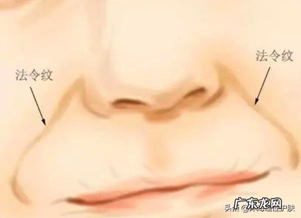 如何祛除法令纹和抬头纹？