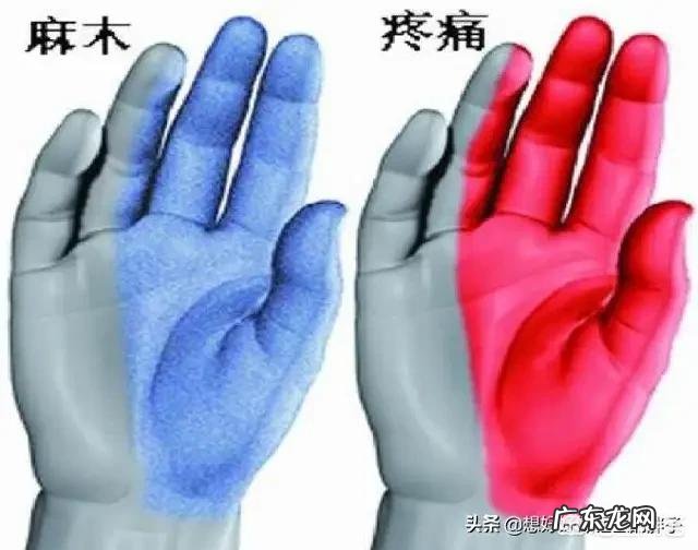 手指发麻是是什么情况 手指发麻怎么办?是什么原因?