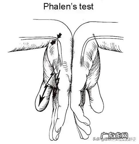 手指发麻是是什么情况 手指发麻怎么办?是什么原因?
