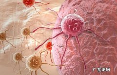 什么人容易得癌症呢为什么有些人检查出来就是晚期呢