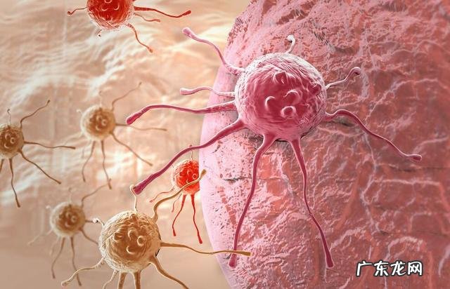 什么人容易得癌症呢为什么有些人检查出来就是晚期呢