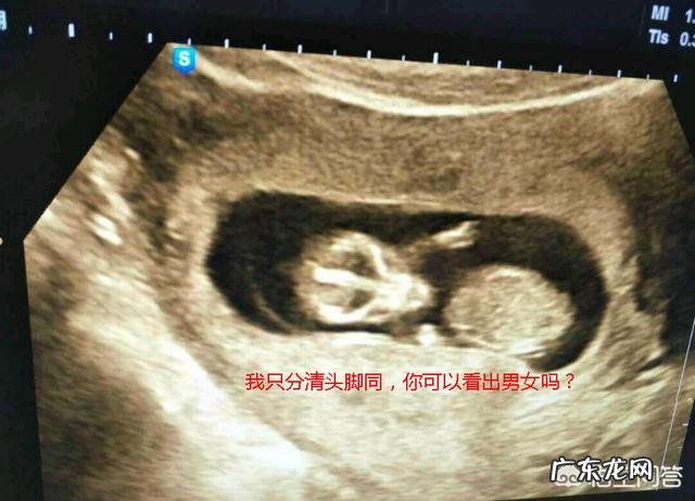 12周胎儿双径是多少正常