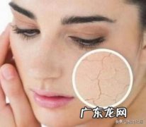 为什么一些人夏天皮肤过敏没冬天多