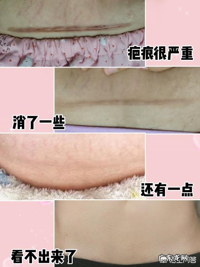 产后很胖,生完孩子一年多了,用什么方法减肥好呢?