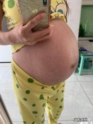 产后腹部松弛，身材走样，还能恢复如初吗？