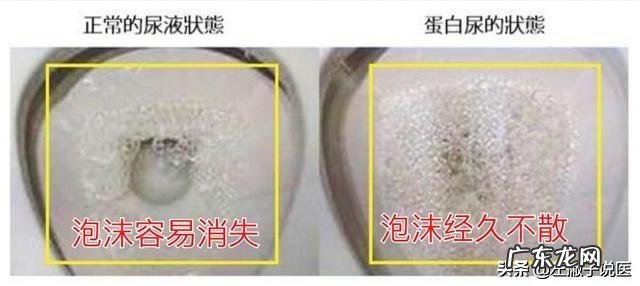 小孩积食尿尿有泡沫怎么办?