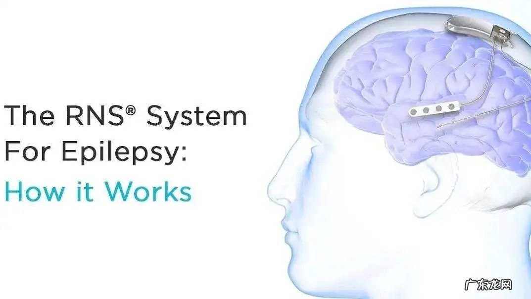 脑控术还是医学革命?脑机接口让人类摆脱AI控制