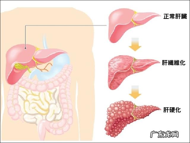 长期不吃晚饭对肝脏有好处吗