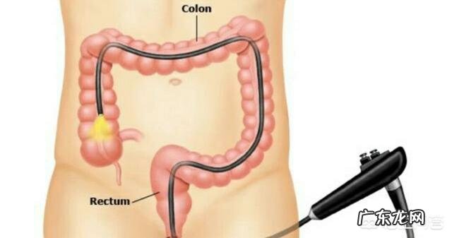 肠道功能紊乱的原因是什么如何调理