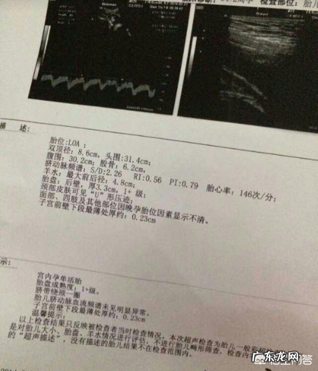 怀孕二十八周的宫高和腹围是多少正常?