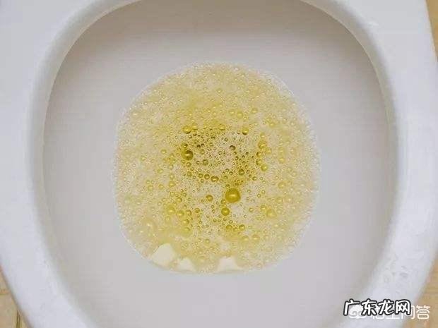 肾结石或尿道结石有什么症状?