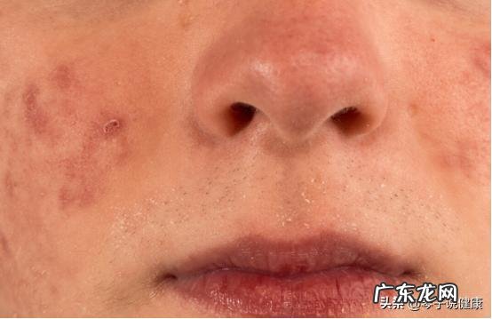 补气血就喝它，比红枣管用，经常喝气色好，喝的是什么？