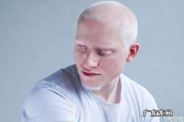 白化病是怎么引起的呢 如果预防白化病呢