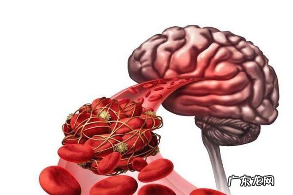 什么是偏瘫呢 偏瘫有什么危害呢