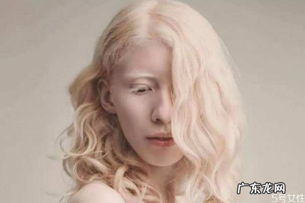 什么是白化病呢 白化病有什么危害呢