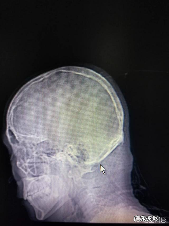 魏氏正骨青紫堂是真的吗效果如何∞?