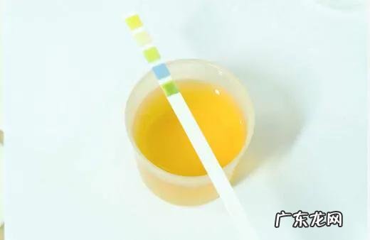 泡沫尿,潜血3+,怎么办?