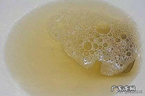 泡沫尿,潜血3+,怎么办?