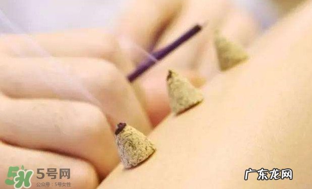 刚怀孕可以艾灸吗?刚怀孕可以艾灸腹部吗