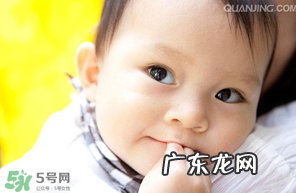 白癜风会遗传吗?白癜风会遗传给下一代吗?