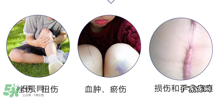 hirudoid除疤膏有效吗?hirudoid去疤膏效果如何?