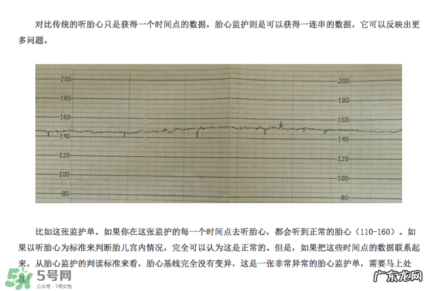 胎心仪有必要买吗?胎心仪是不是必需品?