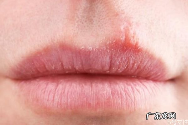 唇色暗淡怎么改善 如何保养嘴唇