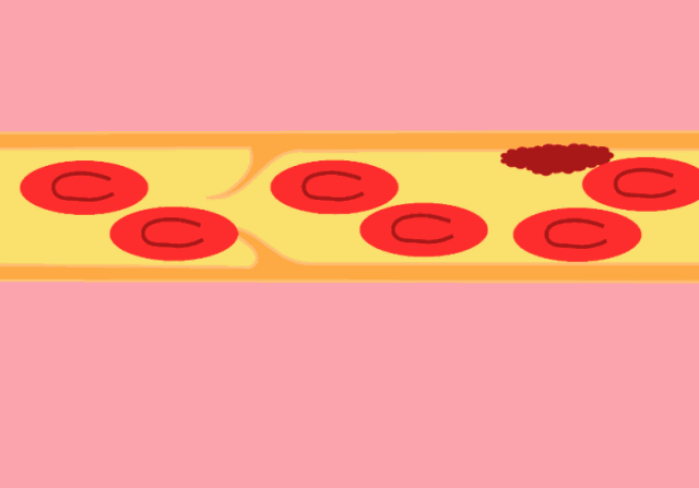 产后发汗对月子病有效果吗?