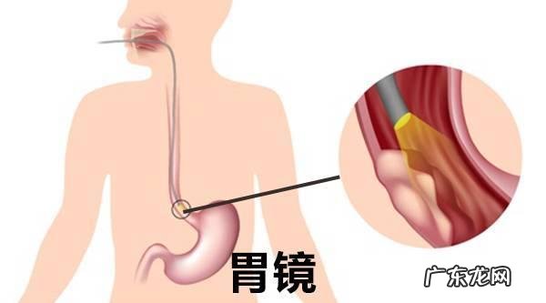 咽炎可以引起什么并发症？