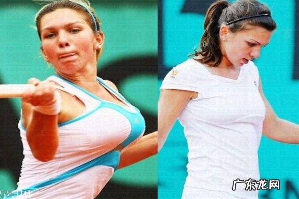 缩胸手术是什么 为什么要做缩胸手术