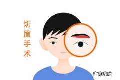 切眉有什么作用 为什么要切眉
