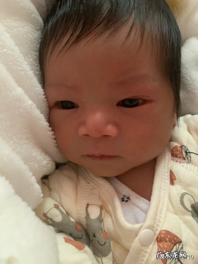 生完孩子后肚皮松弛还易胖应该怎么办？