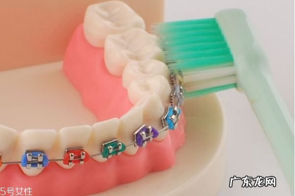 支抗钉有哪些用途 什么情况需要打支抗钉