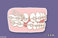 支抗钉有哪些用途 什么情况需要打支抗钉