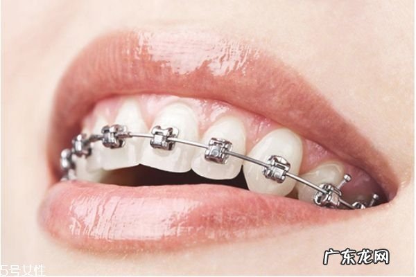 打支抗钉疼吗 支抗钉打与不打的区别