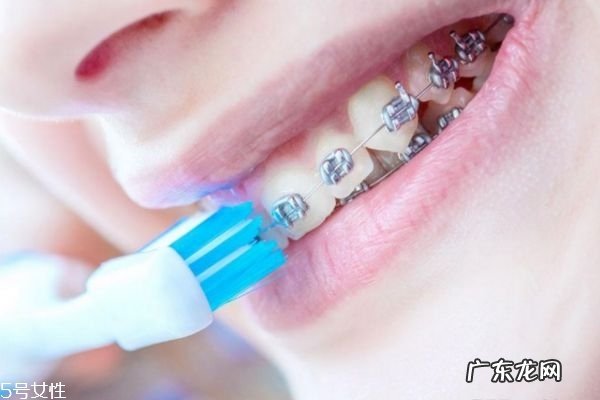 打支抗钉疼吗 支抗钉打与不打的区别