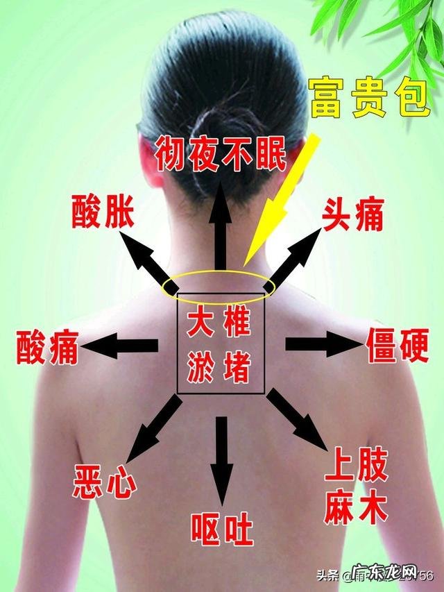 人肩膀上的富贵包要怎么才消除?