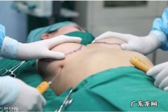 假体隆胸后多久才能趴着睡 假体隆胸趴着睡的好处