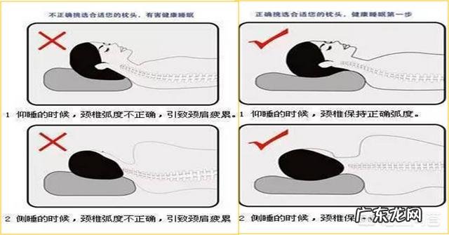 长久头前倾导致脖子后面隆起一块怎么通过运动改善?